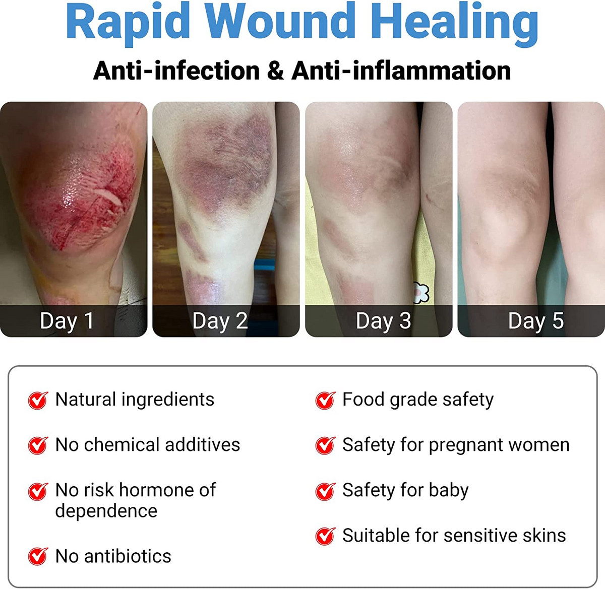 LMNOOP® Wound Healing Ointment, for Chronic Wound, Bedsore, Skin Ulcers, Cellulitis, Burns, Sores, Surgical Wound, Infected Wound, Cuts, Blisters, Pain Relief, Anti-Infection, Anti-inflammatory Cream (50g)