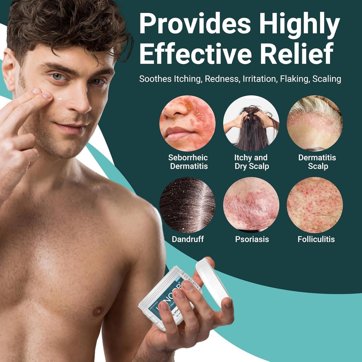 Extra Strength Seborrheic Dermatitis Cream & Scalp Treatment - Effectively Treats Psoriasis, Eczema, Dandruff, Folliculitis, Dry & Itchy Scalp - Anti-Itch, Soothing Relief - 3.5 oz