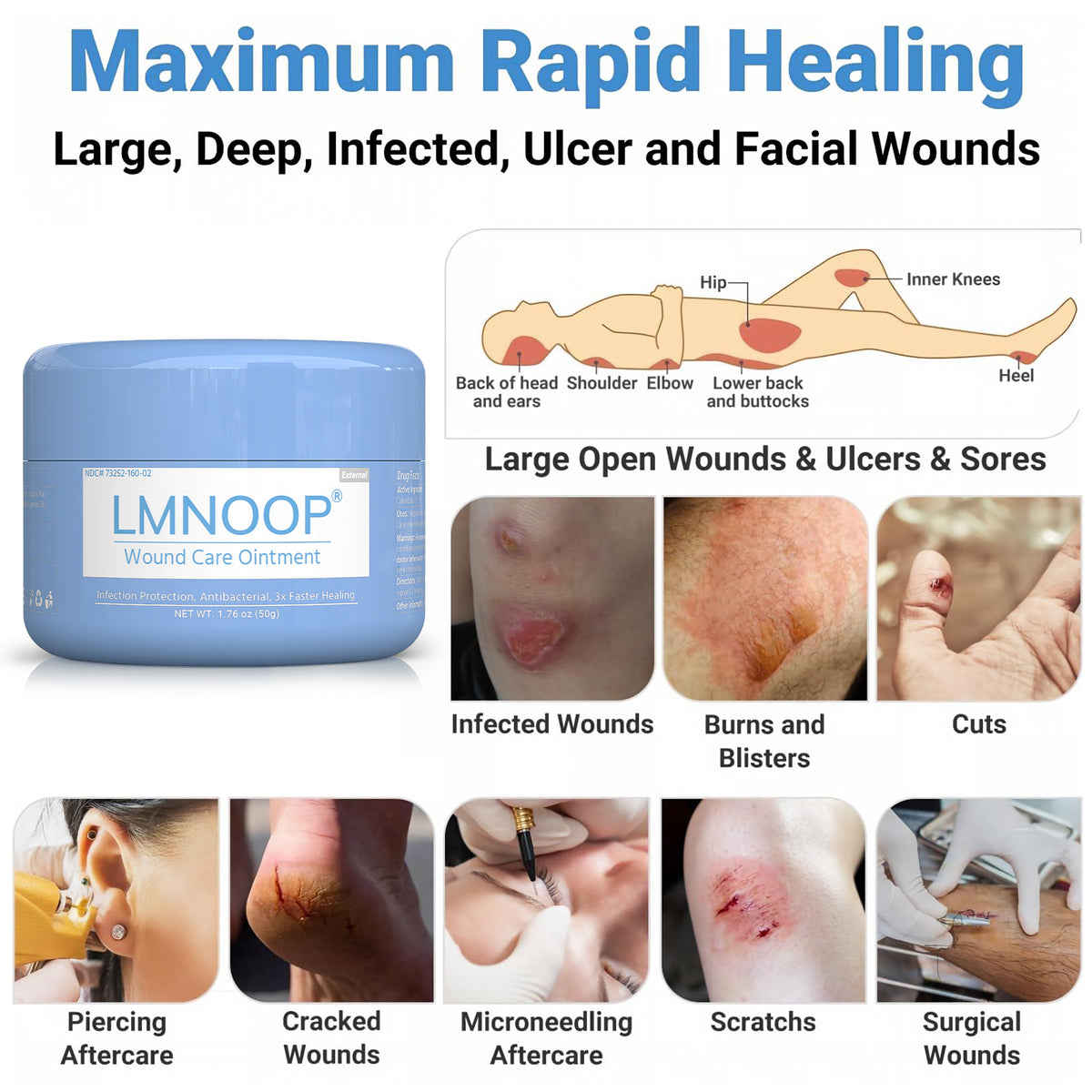 LMNOOP® Wound Healing Ointment, for Chronic Wound, Bedsore, Skin Ulcers, Cellulitis, Burns, Sores, Surgical Wound, Infected Wound, Cuts, Blisters, Pain Relief, Anti-Infection, Anti-inflammatory Cream (50g)