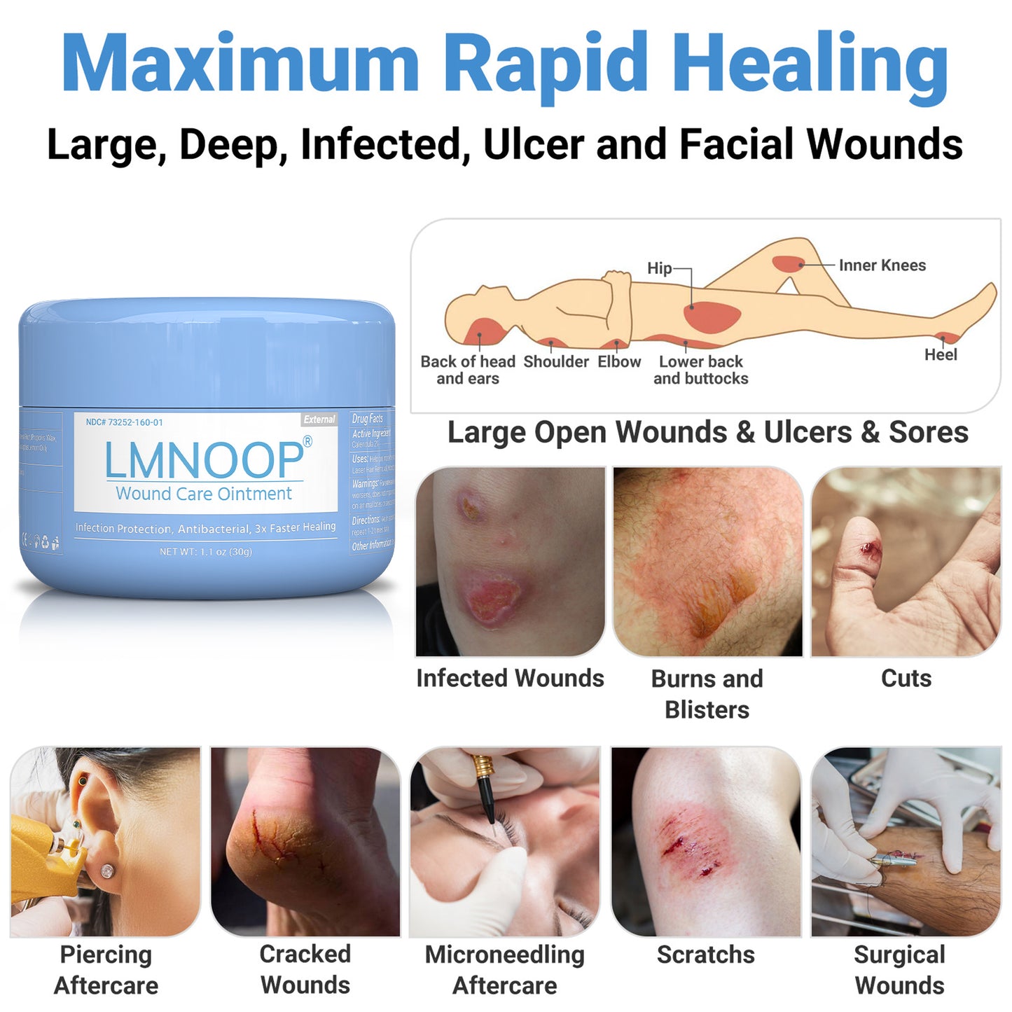 LMNOOP® Wound Care Cream for Infection Ulcers Sores Cuts Scrapes Burns Bites Surgical Open & Deep Wounds and Various Wounds, First Aid Skin Repair Ointment for Hard to Heal Wounds on Back Leg Buttock (30g)