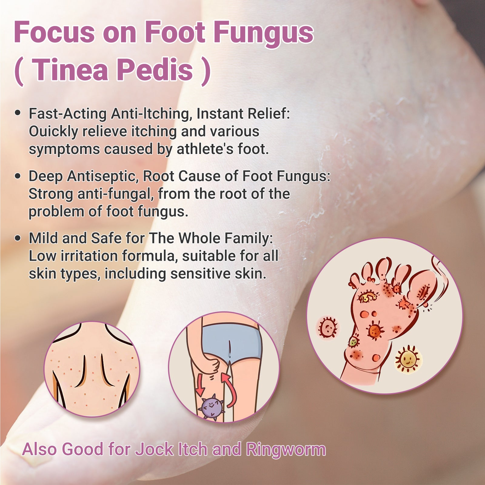 Defense Antifungal Bar Soap Jock Itch Ringwor Athletes Foot Skin