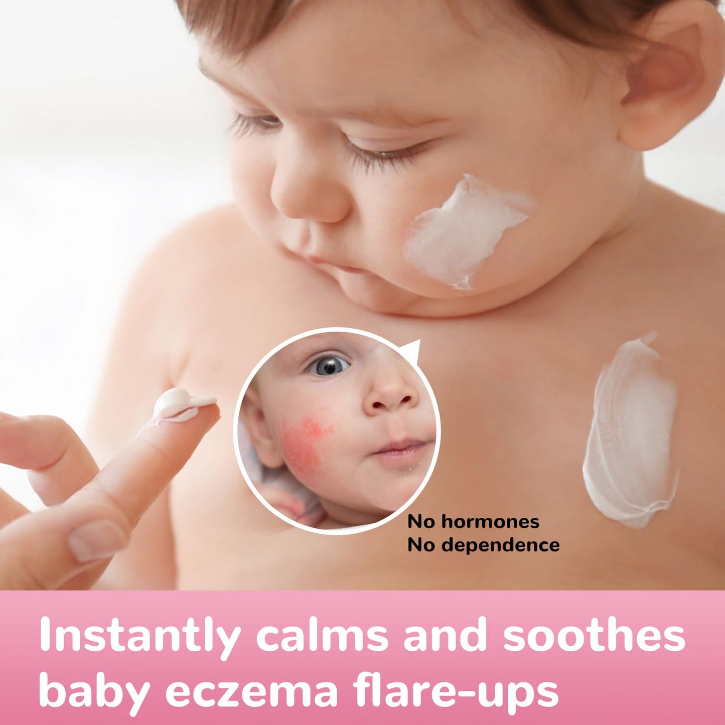 Baby Eczema Relief Cream, All-Natural Herbal Formula for Safe, Soothing Skin Protection Against Rashes, Dryness, Redness, and Itchiness, 3.53oz