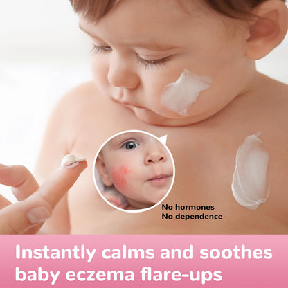 Baby Eczema Relief Cream, All-Natural Herbal Formula for Safe, Soothing Skin Protection Against Rashes, Dryness, Redness, and Itchiness, 3.53oz