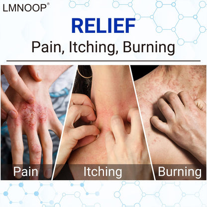 LMNOOP® Eczema Cream, Maximum Strength Treatment Ointment for Dermatitis, Rash, Psoriasis, Urticaria, Tinea Pedis, Fungal Infection, Anti-Itch, Relief for Sensitive & Irritated Skin, 1.76oz 2PCS
