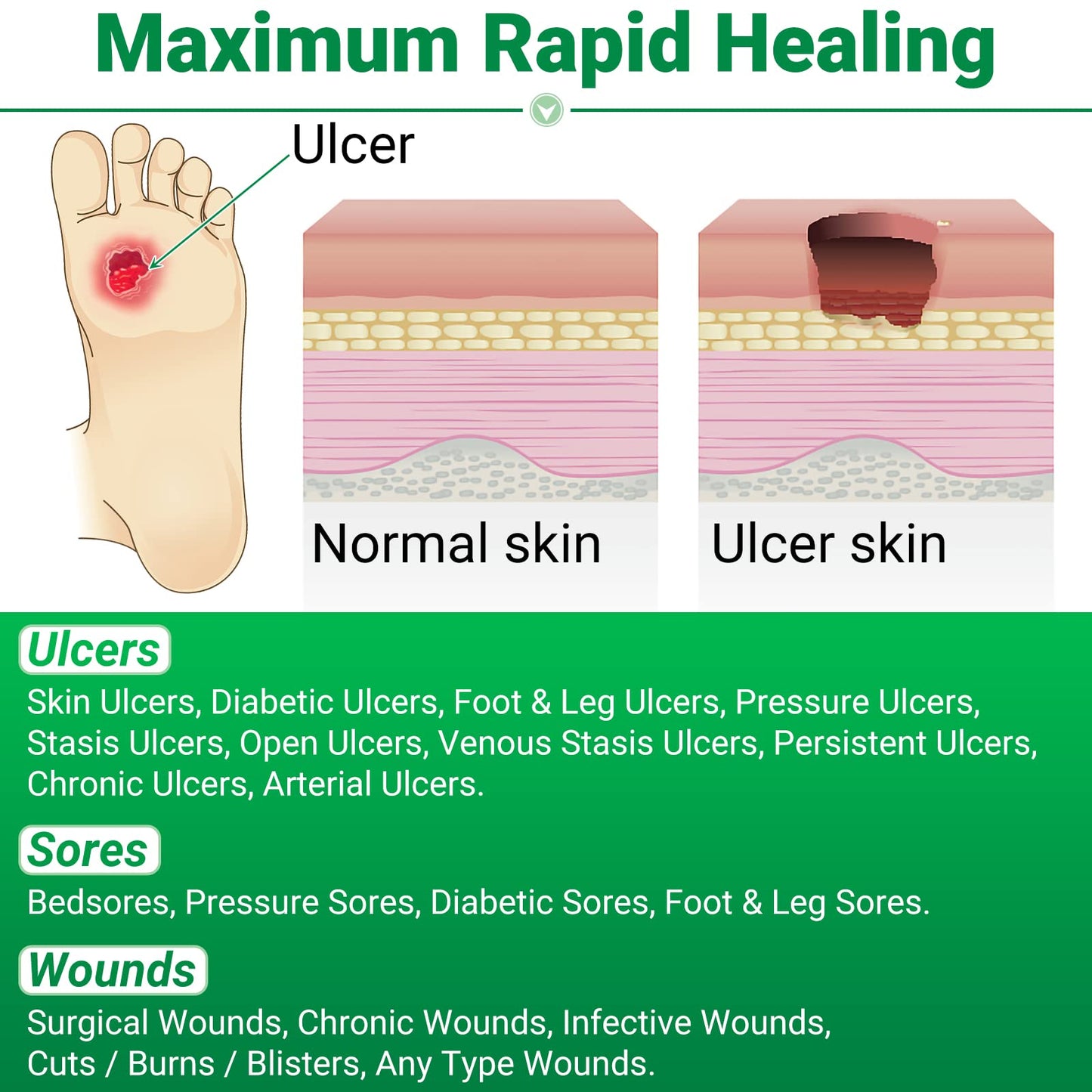 LMNOOP® Skin Ulcer Healing Ointment, for Foot & Leg Ulcers, Sores, Varicose Ulcers, Stasis Ulcers, Bedsores, Cuts, Burns, Skin Infections, Natural Ingredients Deep Wound Healing Ointment