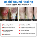 LMNOOP® Wound Care Cream for Infection Ulcers Sores Cuts Scrapes Burns Bites Surgical Open & Deep Wounds and Various Wounds, First Aid Skin Repair Ointment for Hard to Heal Wounds on Back Leg Buttock