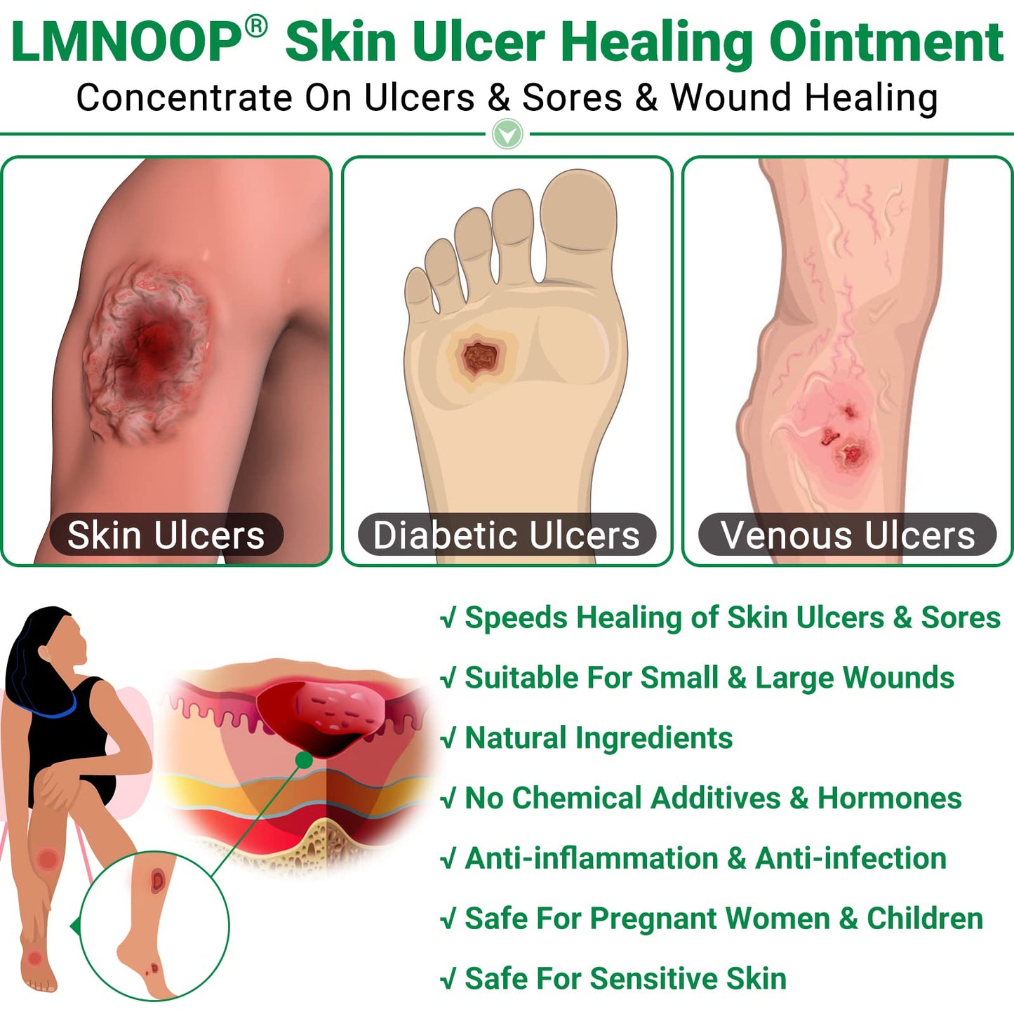 LMNOOP® Skin Ulcer Healing Ointment, for Foot & Leg Ulcers, Sores, Varicose Ulcers, Stasis Ulcers, Bedsores, Cuts, Burns, Skin Infections, Natural Ingredients Deep Wound Healing Ointment