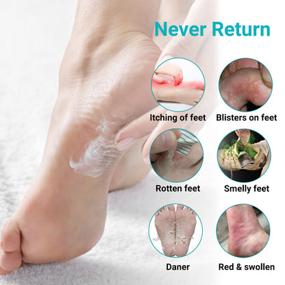 Athletes Foot Treatment Cream, Maximum Strength for Athlete's Foot (Tinea Pedis), Itching, Blister, Burning, Cracking, Scaling, Beriberi,Natural Herbs Antifungal Foot Cream (2-Pack)