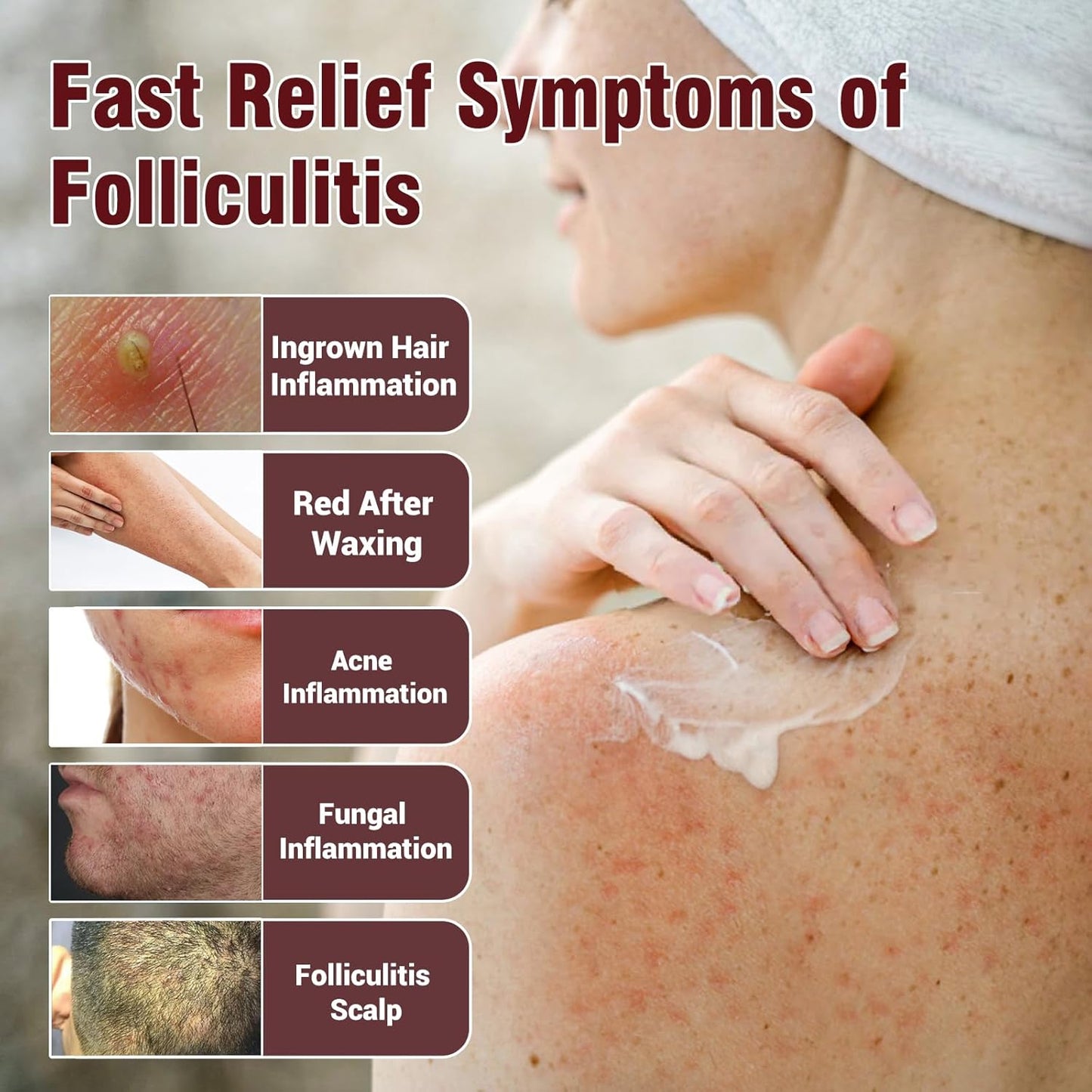 Folliculitis Treatment Cream, Natural Ingredients, Valid Relieve, for Itching, Lichen, Redness, Inflammation, Fast Non-Irritating - 3.52oz