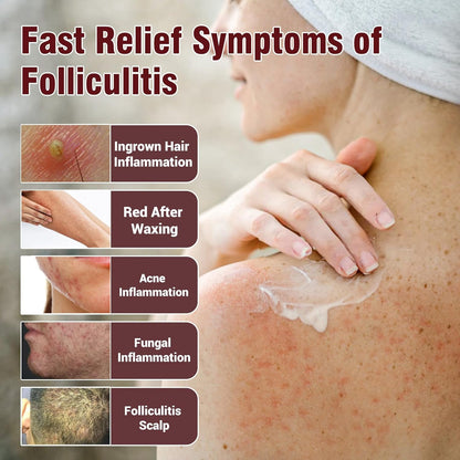 Folliculitis Treatment Cream, Natural Ingredients, Valid Relieve, for Itching, Lichen, Redness, Inflammation, Fast Non-Irritating - 3.52oz