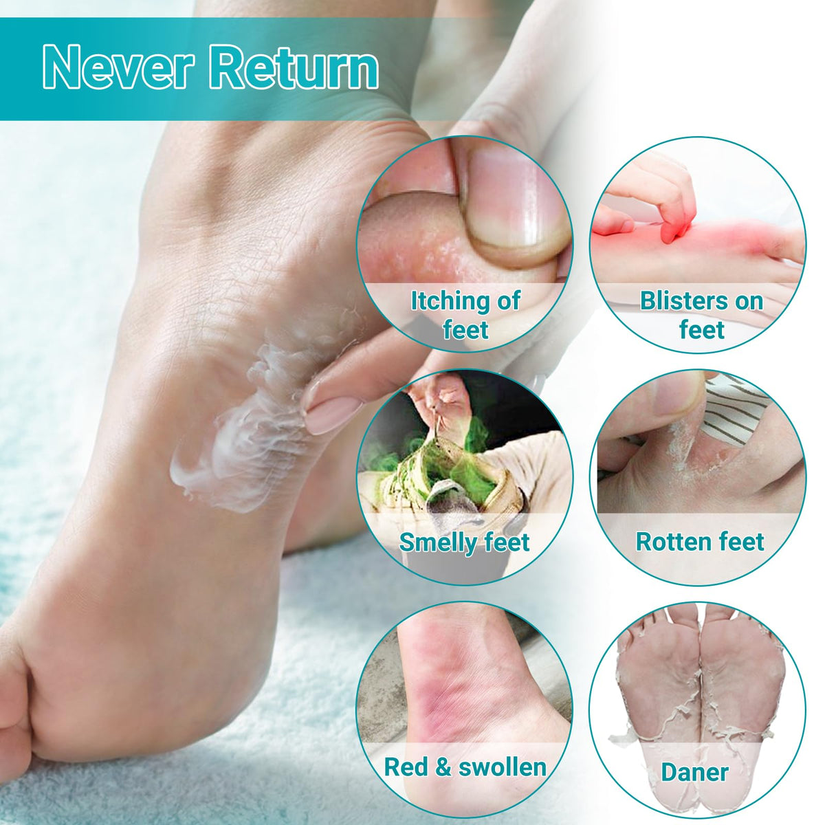 Athletes Foot Treatment Cream, Maximum Strength for Athlete's Foot (Tinea Pedis), Itching, Blister, Burning, Cracking, Scaling, Beriberi,Natural Herbs Antifungal Foot Cream