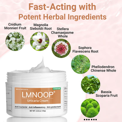 Urticaria Cream for Hives Relief - Fast Acting Anti Itch Treatment with All Natural Herbal Formula for Skin Allergic Rashes, Redness, Swelling 3.53 oz