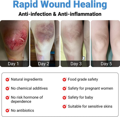 LMNOOP® Wound Healing Ointment, for Chronic Wound, Bedsore, Skin Ulcers, Cellulitis, Burns, Sores, Surgical Wound, Infected Wound, Cuts, Blisters, Pain Relief, Anti-Infection, Anti-inflammatory Cream (50g)