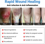 LMNOOP® Wound Healing Ointment, for Chronic Wound, Bedsore, Skin Ulcers, Cellulitis, Burns, Sores, Surgical Wound, Infected Wound, Cuts, Blisters, Pain Relief, Anti-Infection, Anti-inflammatory Cream
