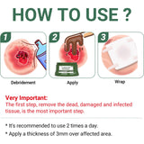 Perianal Repair Ointment: Treatments for Anal Fistula, Anal Fissure, Perianal Abscess, Rapid Relief from Pain, Burning, Itching, Swelling, Bleeding, and Discomfort by Jock Itch or Hemorrhoids (5PCS)
