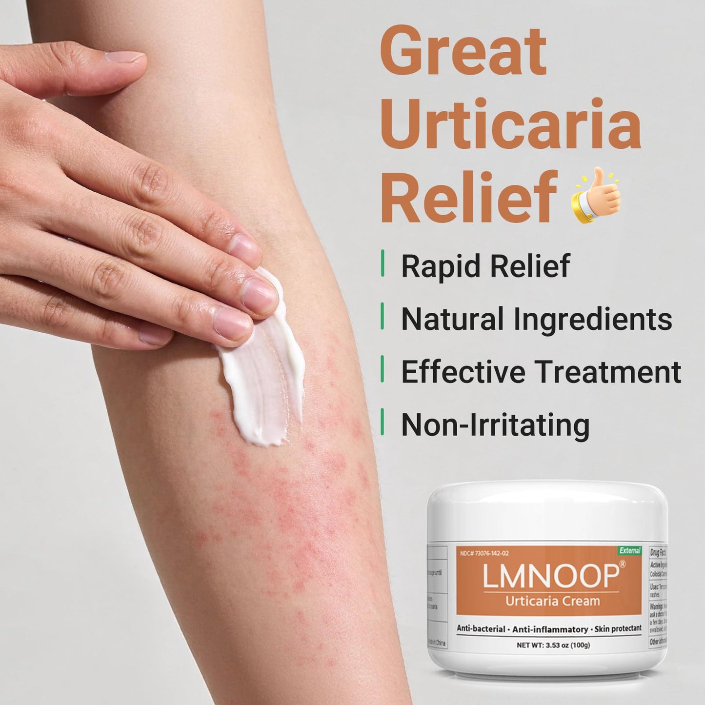Urticaria Cream for Hives Relief - Fast Acting Anti Itch Treatment with All Natural Herbal Formula for Skin Allergic Rashes, Redness, Swelling 7.06 oz