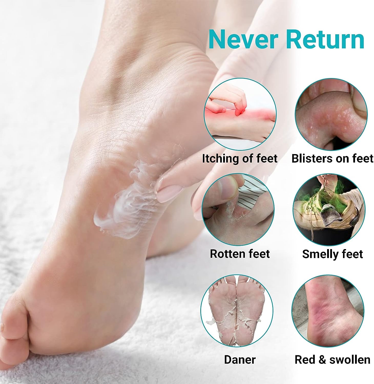 Heel Callus Foot Fungus Severe Cracked Heels Causes LMNOOP