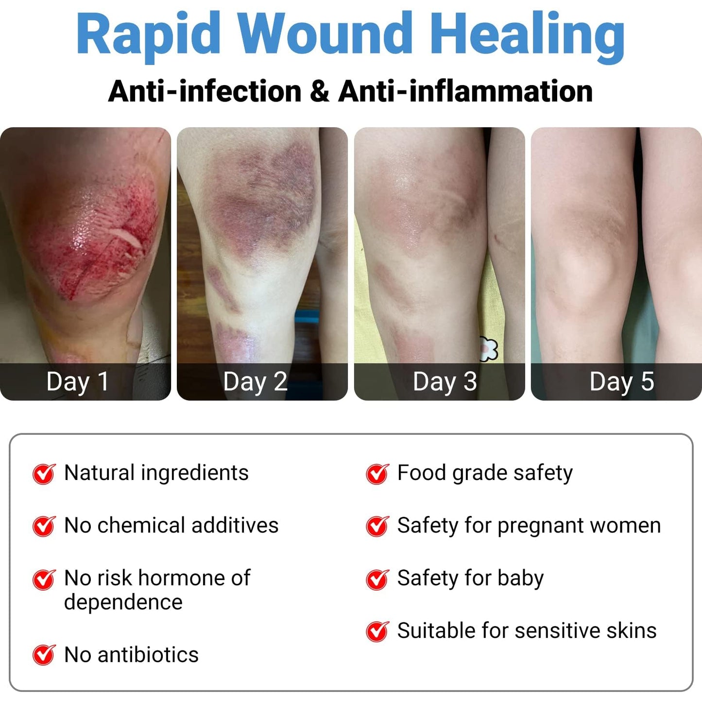 LMNOOP® Wound Care Cream for Infection Ulcers Sores Cuts Scrapes Burns Bites Surgical Open & Deep Wounds and Various Wounds, First Aid Skin Repair Ointment for Hard to Heal Wounds on Back Leg Buttock (30g)