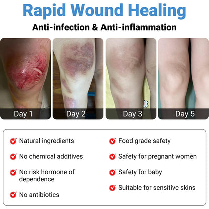 LMNOOP® Wound Care Cream for Infection Ulcers Sores Cuts Scrapes Burns Bites Surgical Open & Deep Wounds and Various Wounds, First Aid Skin Repair Ointment for Hard to Heal Wounds on Back Leg Buttock (30g)