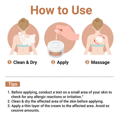 Urticaria Cream for Hives Relief - Fast Acting Anti Itch Treatment with All Natural Herbal Formula for Skin Allergic Rashes, Redness, Swelling 7.06 oz