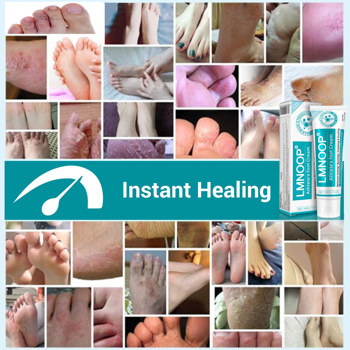 Athletes Foot Treatment Cream, Maximum Strength for Athlete's Foot (Tinea Pedis), Itching, Blister, Burning, Cracking, Scaling, Beriberi,Natural Herbs Antifungal Foot Cream