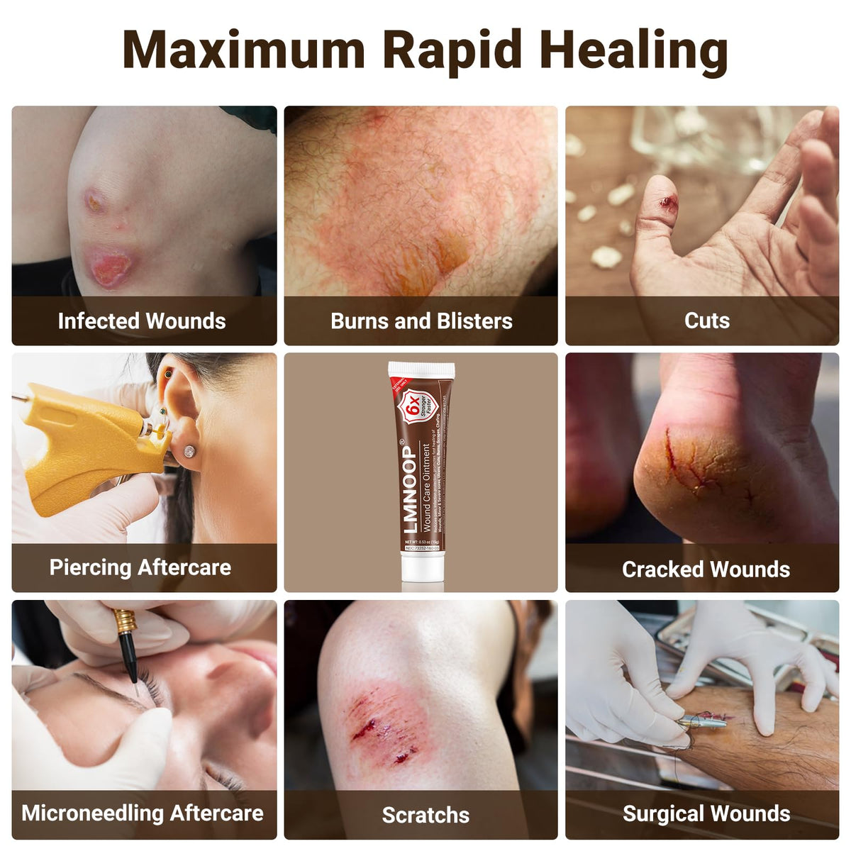 LMNOOP® Wound Care Cream, Skin Healing & Repair Ointment for Infection Ulcers Cuts Scrapes Burns Bites Surgical and Various Wounds, Pressure Treatment Products & Bed Sore Cream