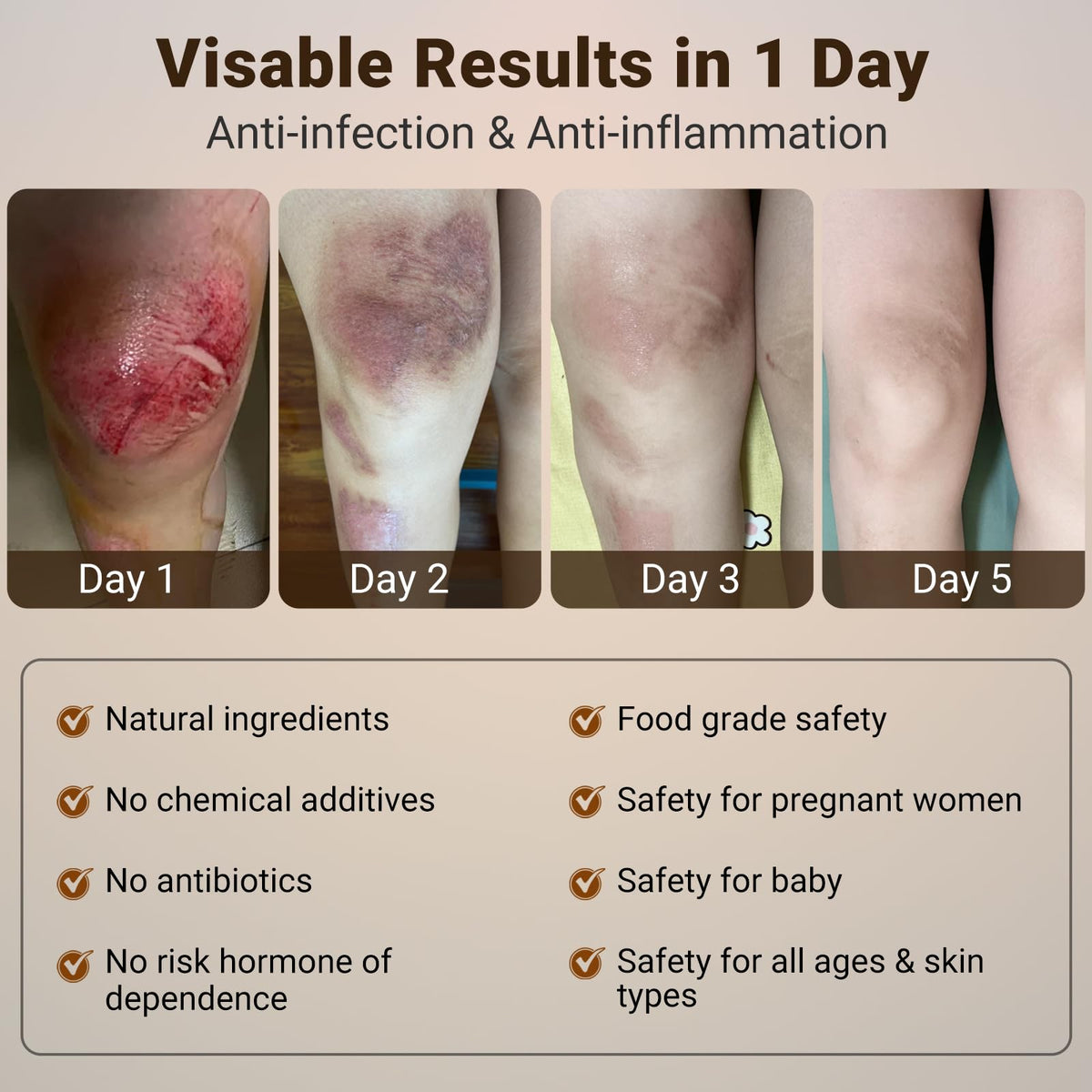 LMNOOP® Wound Care Cream, Skin Healing & Repair Ointment for Infection Ulcers Cuts Scrapes Burns Bites Surgical and Various Wounds, Pressure Treatment Products & Bed Sore Cream