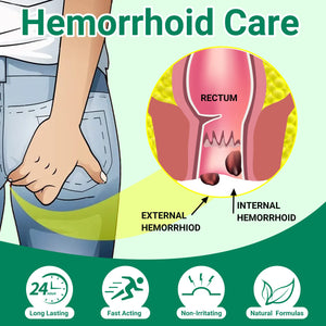 LMNOOP® Hemorrhoid Treatment Ointment, Maximum Strength Treatment & Fast Relief for Pain, Itching, Burning, Swelling, Fissure, Bleeding, Discomfort, Long-Lasting Internal & External Hemorrhoid Cream