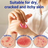 Eczema Cream LMNOOP for Dry, Itchy, Irritated and Eczema Prone Skin, A Variety of Natural Herbal Extracts for Eczema,Psoriasis, Jock Itch,Steroid-Free and Fragrance-Free. (7.05oz / 1.76oz / 3.53oz)